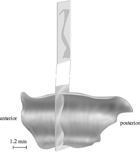 Claustrum Structure page announcement