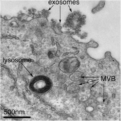 Coronavirus COVID-19 Anatomy of COVID-19 – Dr. Andrew Kaufman